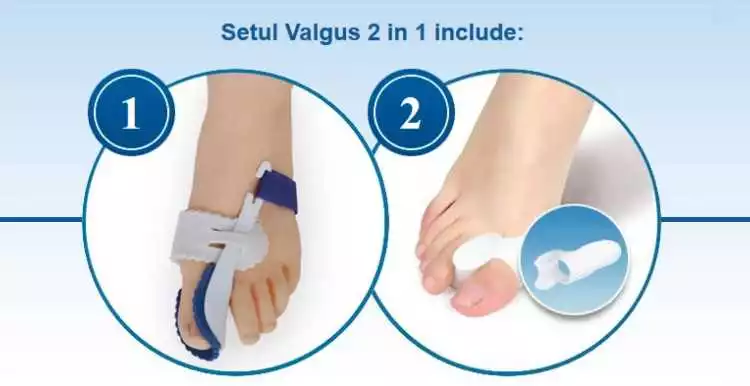 Valgus 2 In 1 - Soluția Pentru Problemele Cu Picioarele